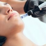 Microneedling Radiance Glow Infusion